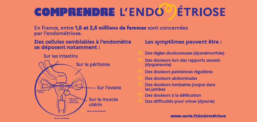 Comprendre l'endométriose